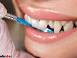 Cara Tradisional Menghilangkan Plak pada Gigi